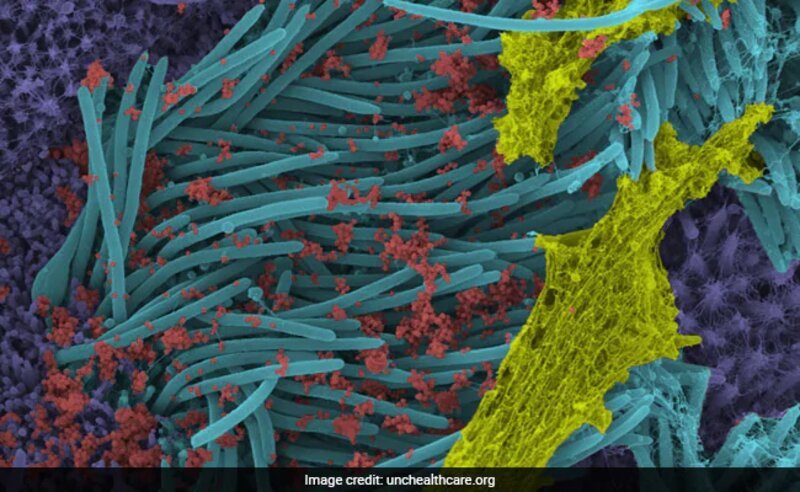 Scientists Publish Images Of Coronavirus Infecting Respiratory Cells