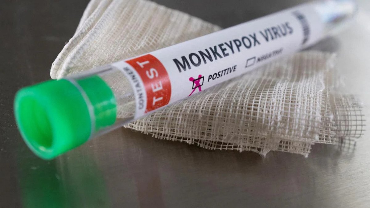 India’s First Indigenously Developed Monkeypox Test Kit Launched