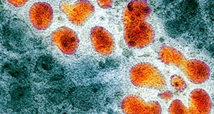 WHO confirms human case of bird flu in India